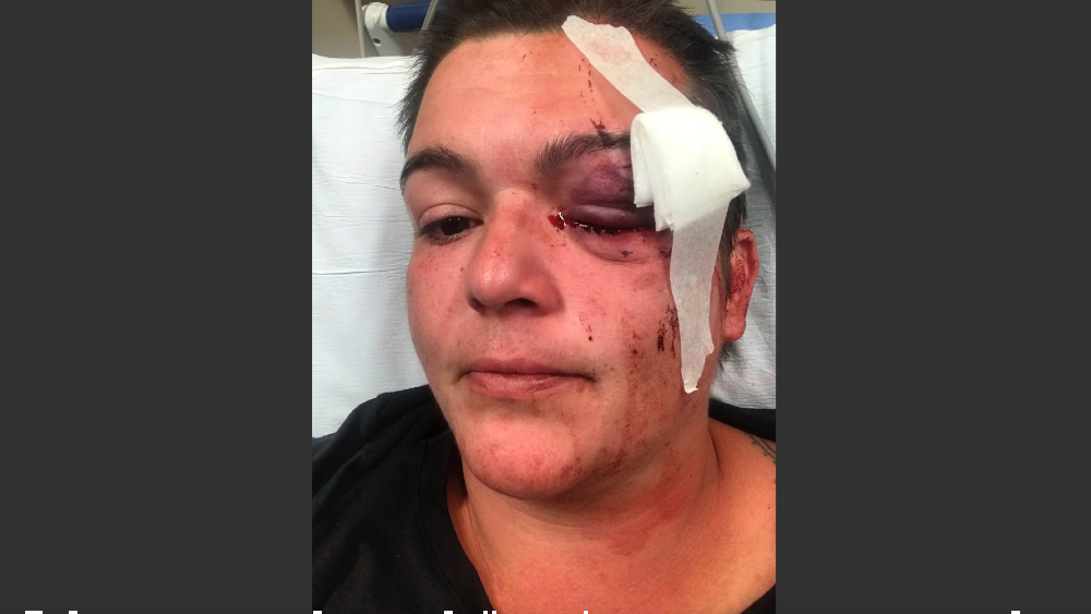 Violencia en EE.UU. es sistémica: fotógrafa que perdió ojo en protestas