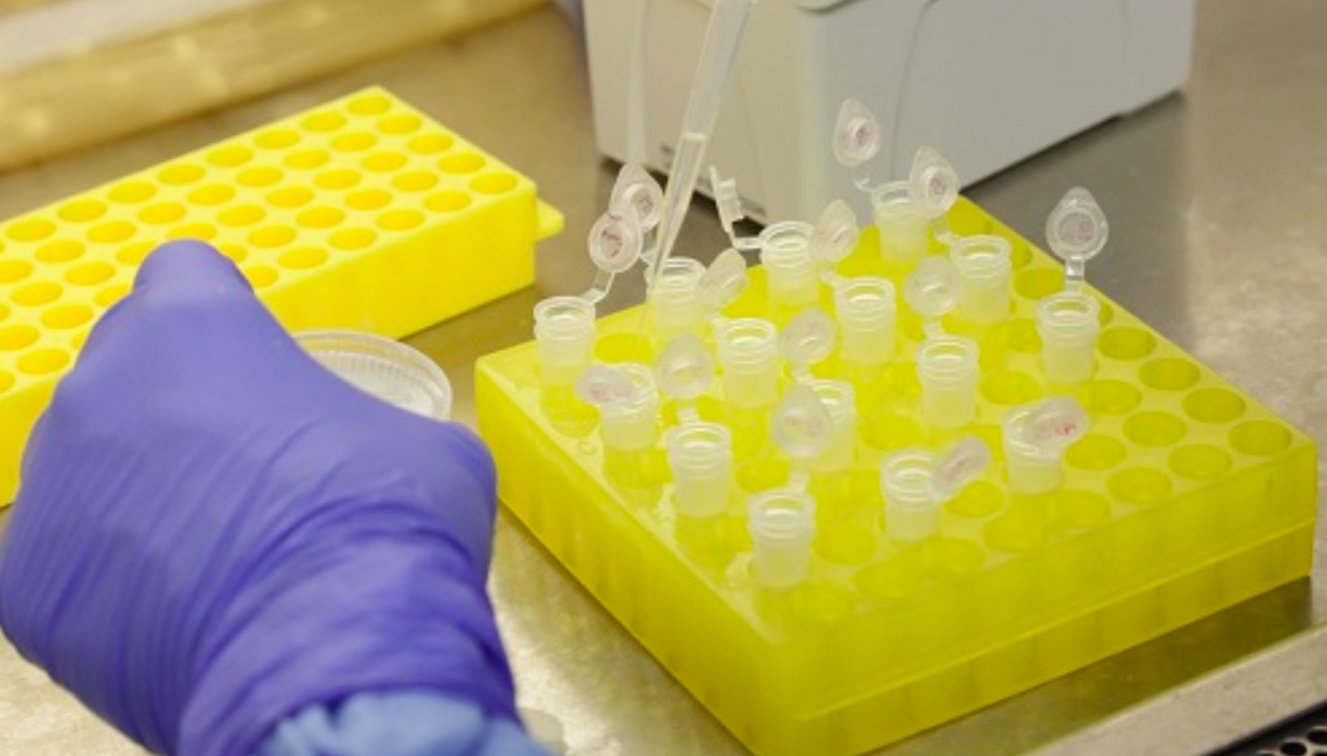 Medicamentos contra hepatitis C impiden duplicidad del COVID-19