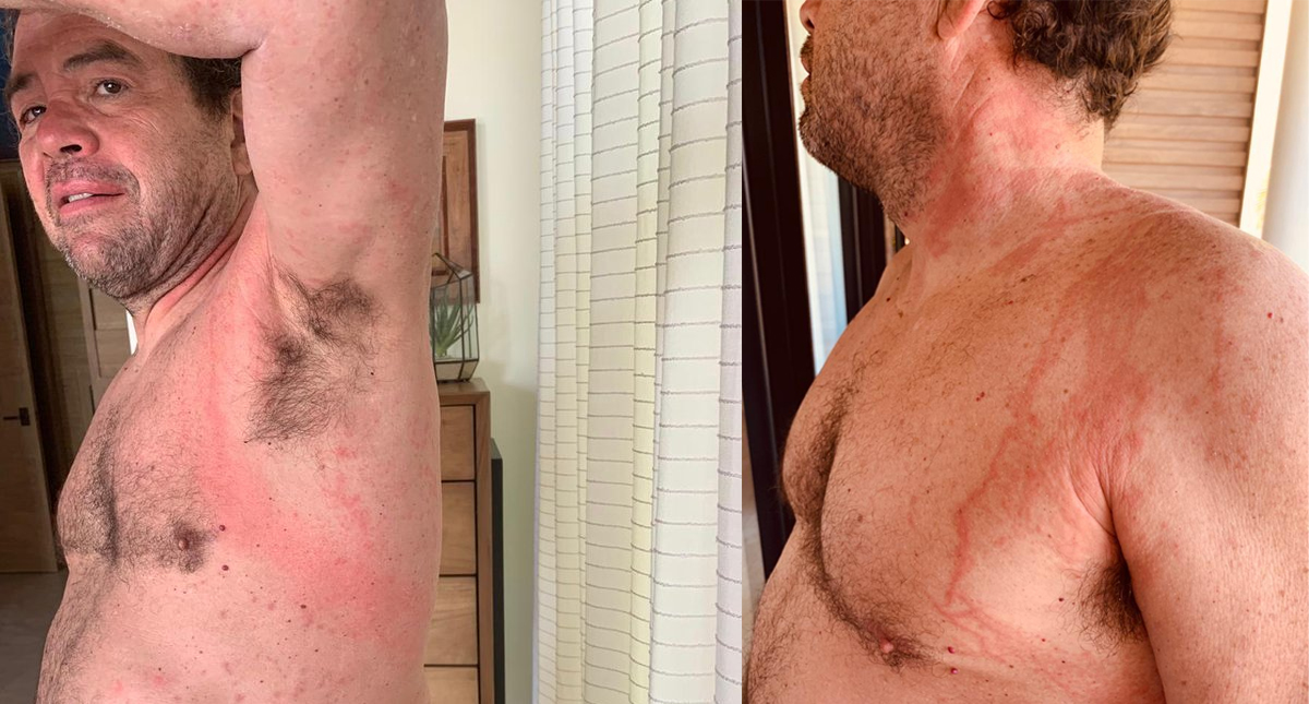 Antonio Argüelles sufre picaduras de medusas durante entrenamiento en Mar de Cortés