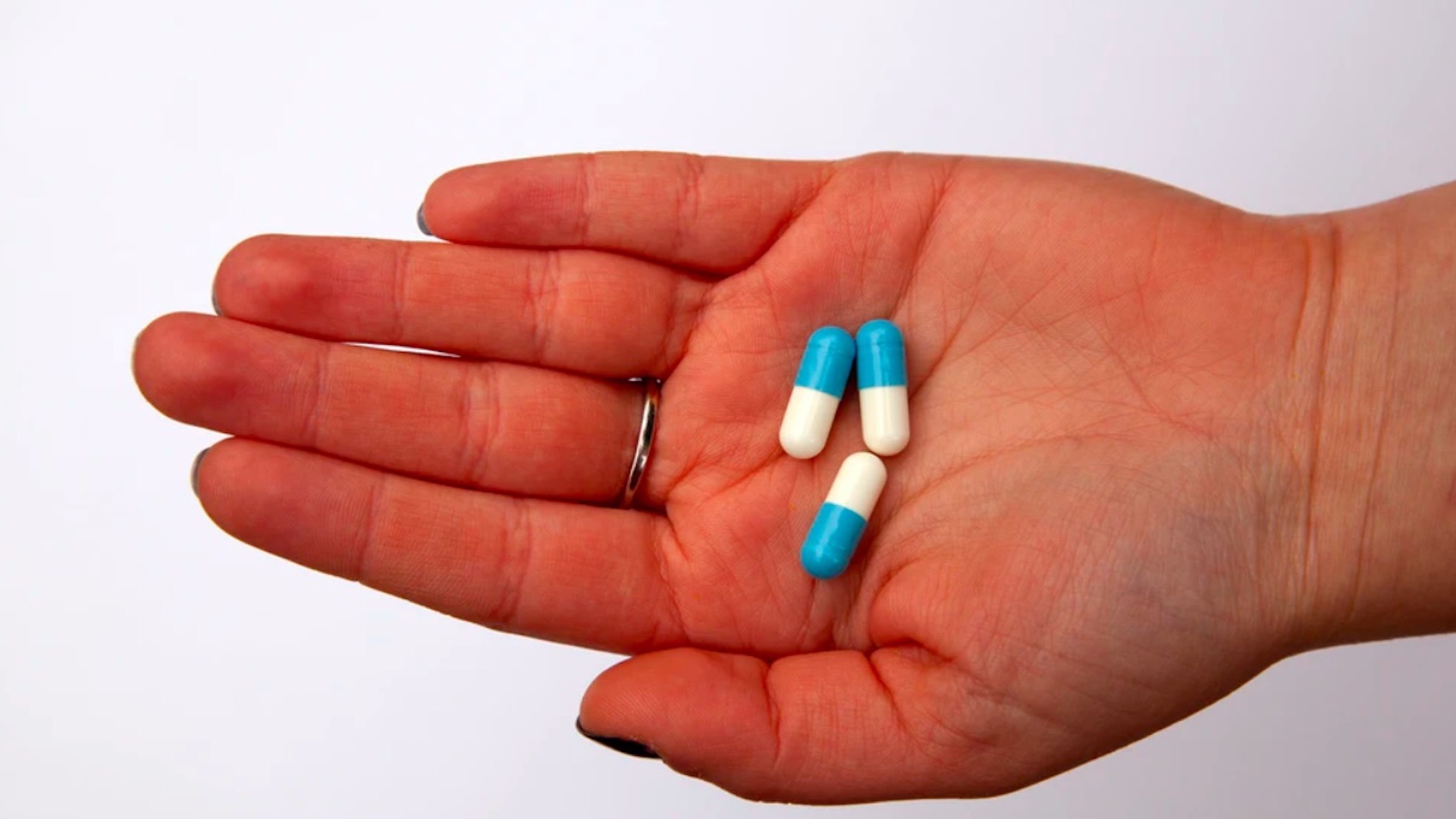 Autocuidado, primordial para preservar la salud y prevenir enfermedades, asevera IMSS