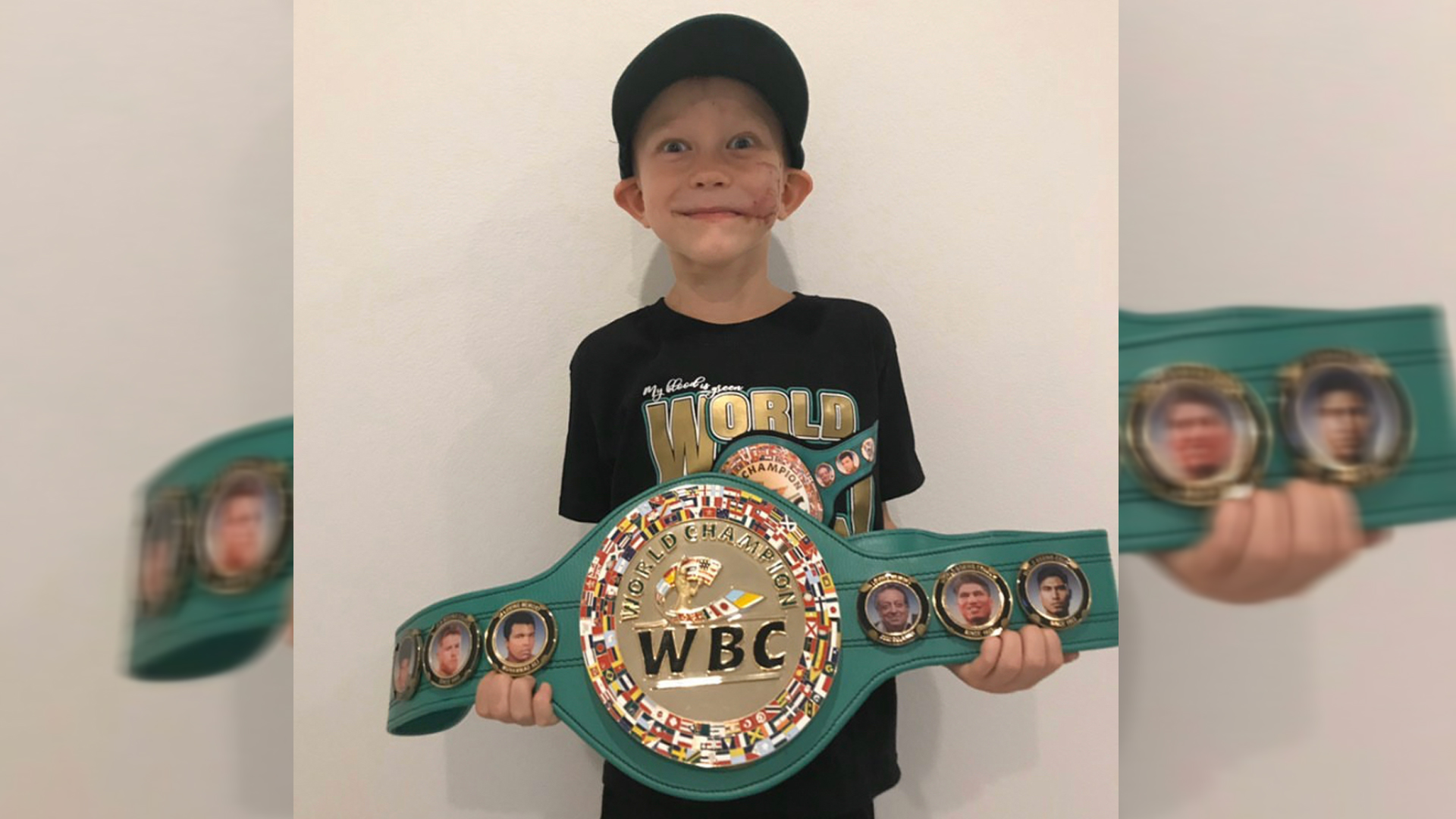 Consejo Mundial de Boxeo reconoce a niño que salvó a su hermana de ataque de perro