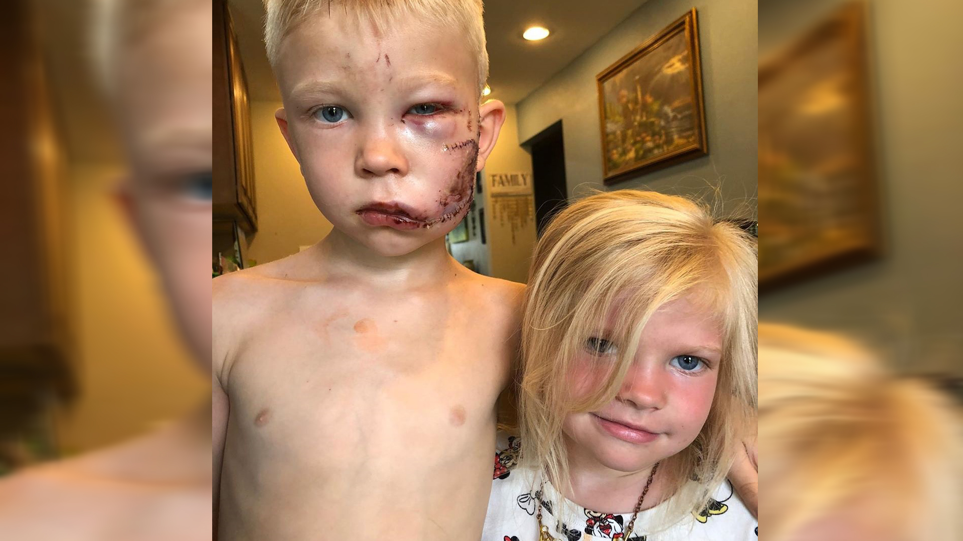 ‘Avengers’ envían emotivos mensajes a niño que salvó a su hermana de ataque de perro