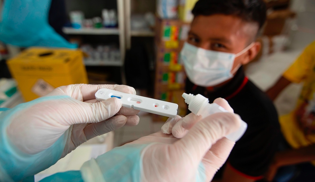 Brasil confirma seis casos de flurona e investiga otros 28