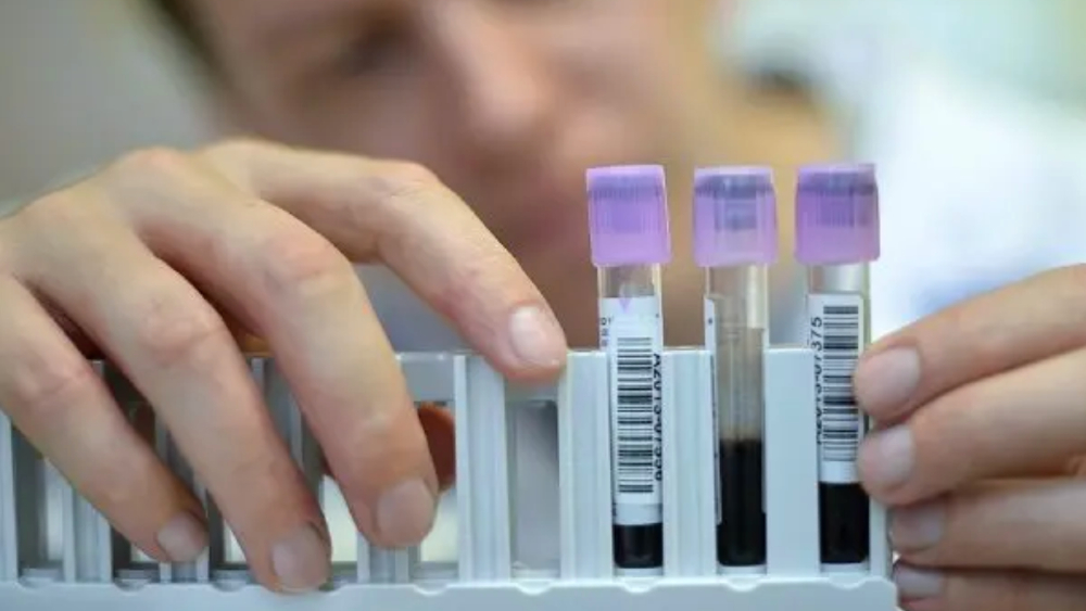 México impulsa primer programa de eliminación de hepatitis C en América