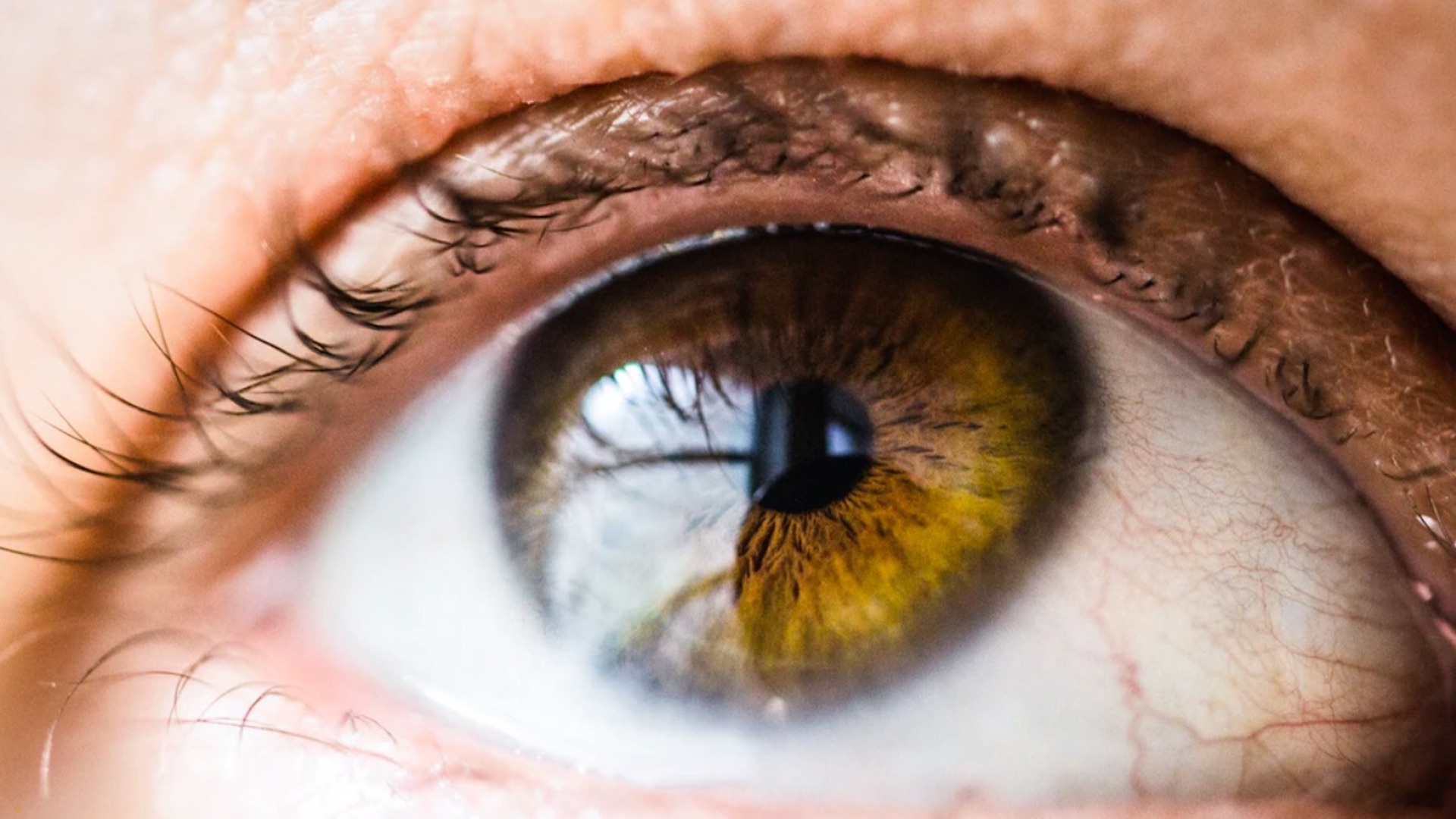 UNAM investiga proteínas involucradas en la formación de cataratas oculares