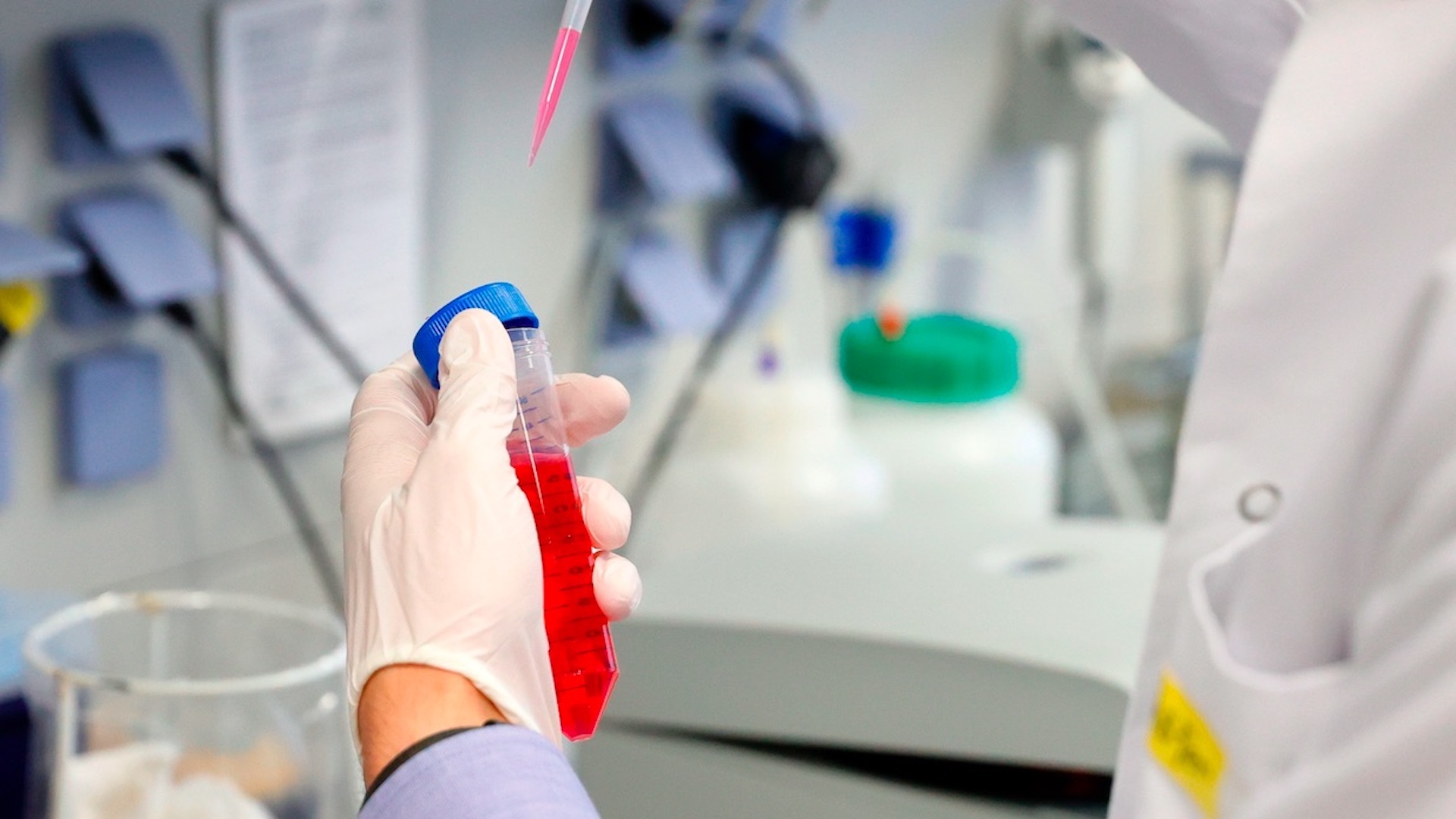 Vacuna contra COVID-19 de la Universidad de Oxford genera anticuerpos y es “segura”