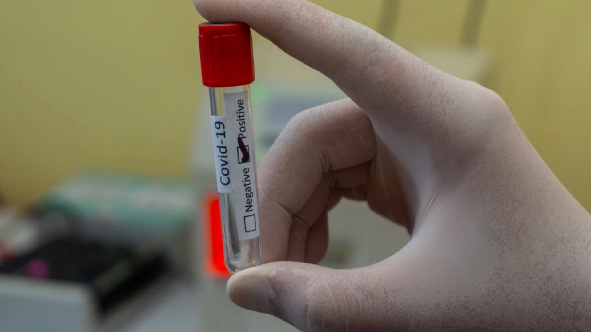 Xolos presenta siete casos de COVID-19 previo a partido con Cruz Azul