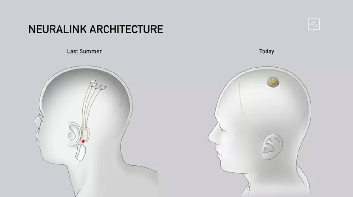 #Video Elon Musk presenta cerdo con chip implantado en el organismo - neuralink-cerdo