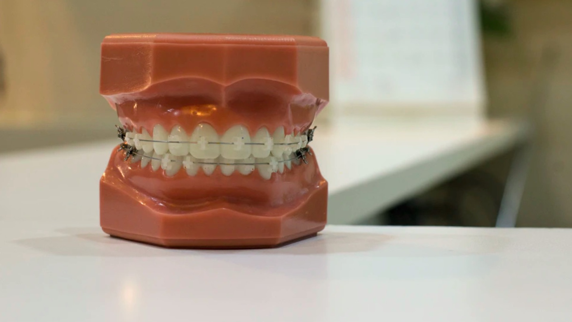 OMS recomienda postergar servicios dentales no esenciales por COVID-19 OMS recomienda postergar servicios dentales no esenciales por COVID-19