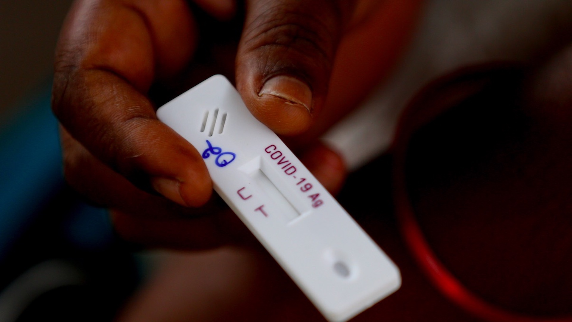 Casos globales de COVID-19 llegan a 30.4 millones; nuevo récord de contagios diarios con más de 316 mil