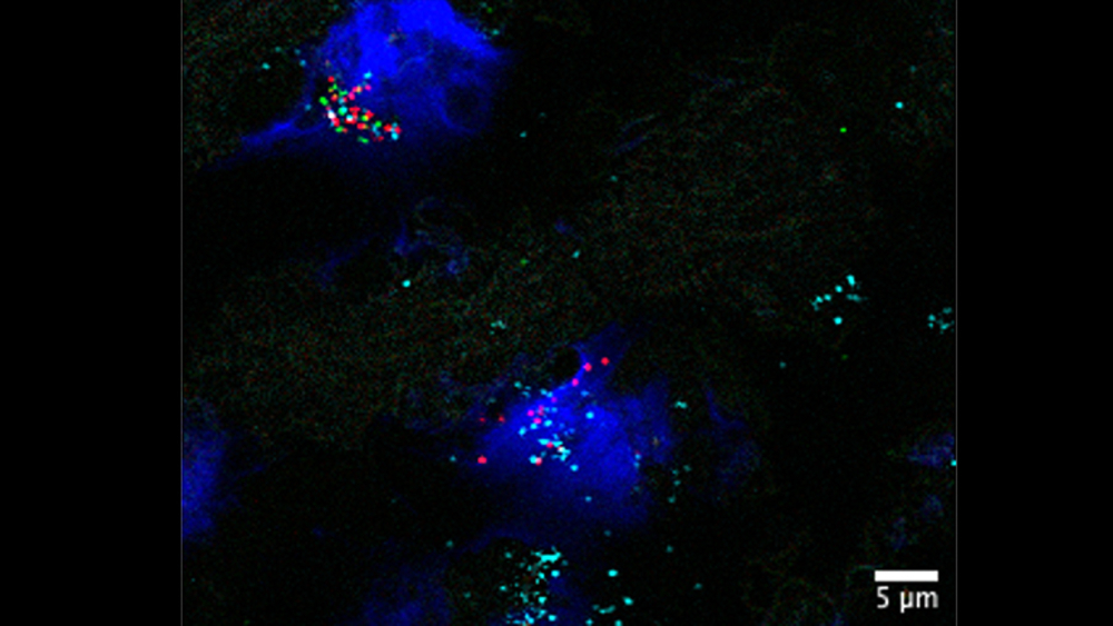 Crean mapa detallado del corazón que podría guiar tratamientos personalizados