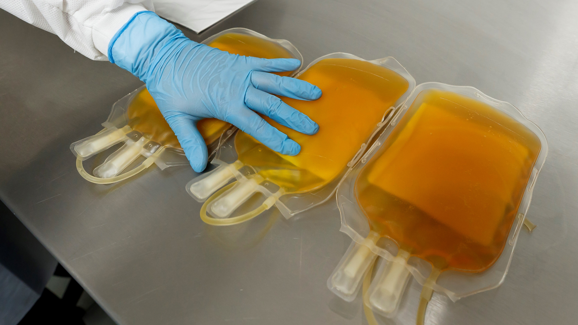 Primer tratamiento basado en plasma de pacientes recuperados de COVID-19 inicia ensayos clínicos Primer tratamiento basado en plasma de pacientes recuperados de COVID-19 inicia ensayos clínicos