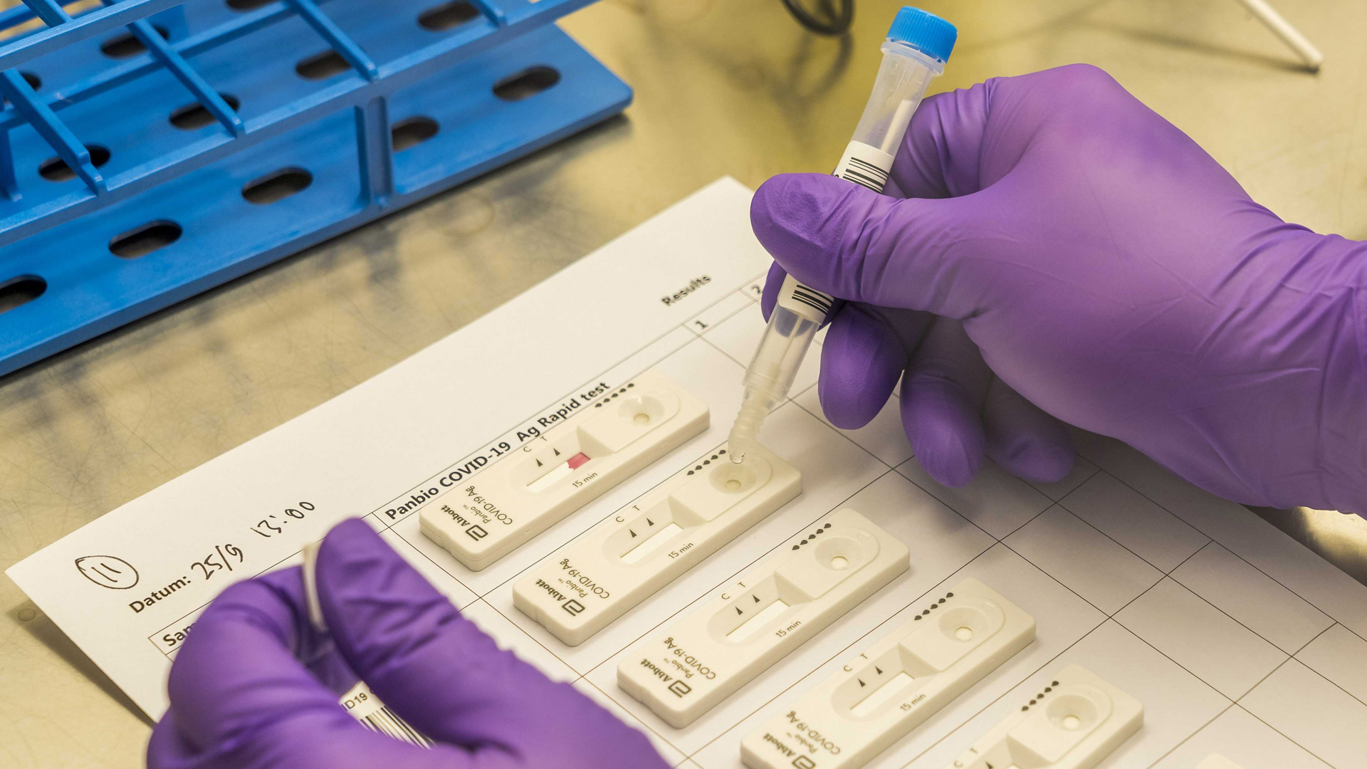 OMS distribuirá 120 millones de pruebas rápidas de COVID-19 a países en desarrollo