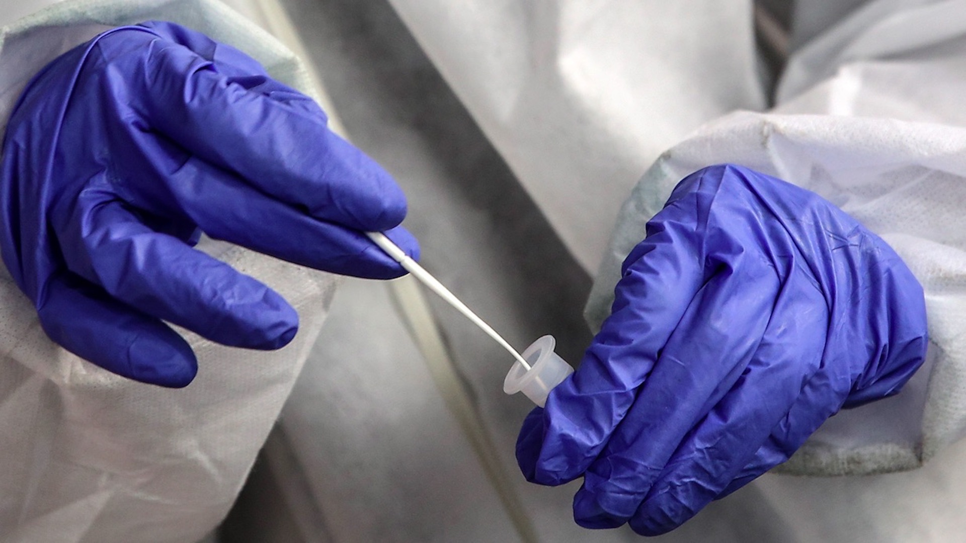 Número de contagios diarios de COVID-19 a nivel global rompe récord con más de medio millón de casos nuevos