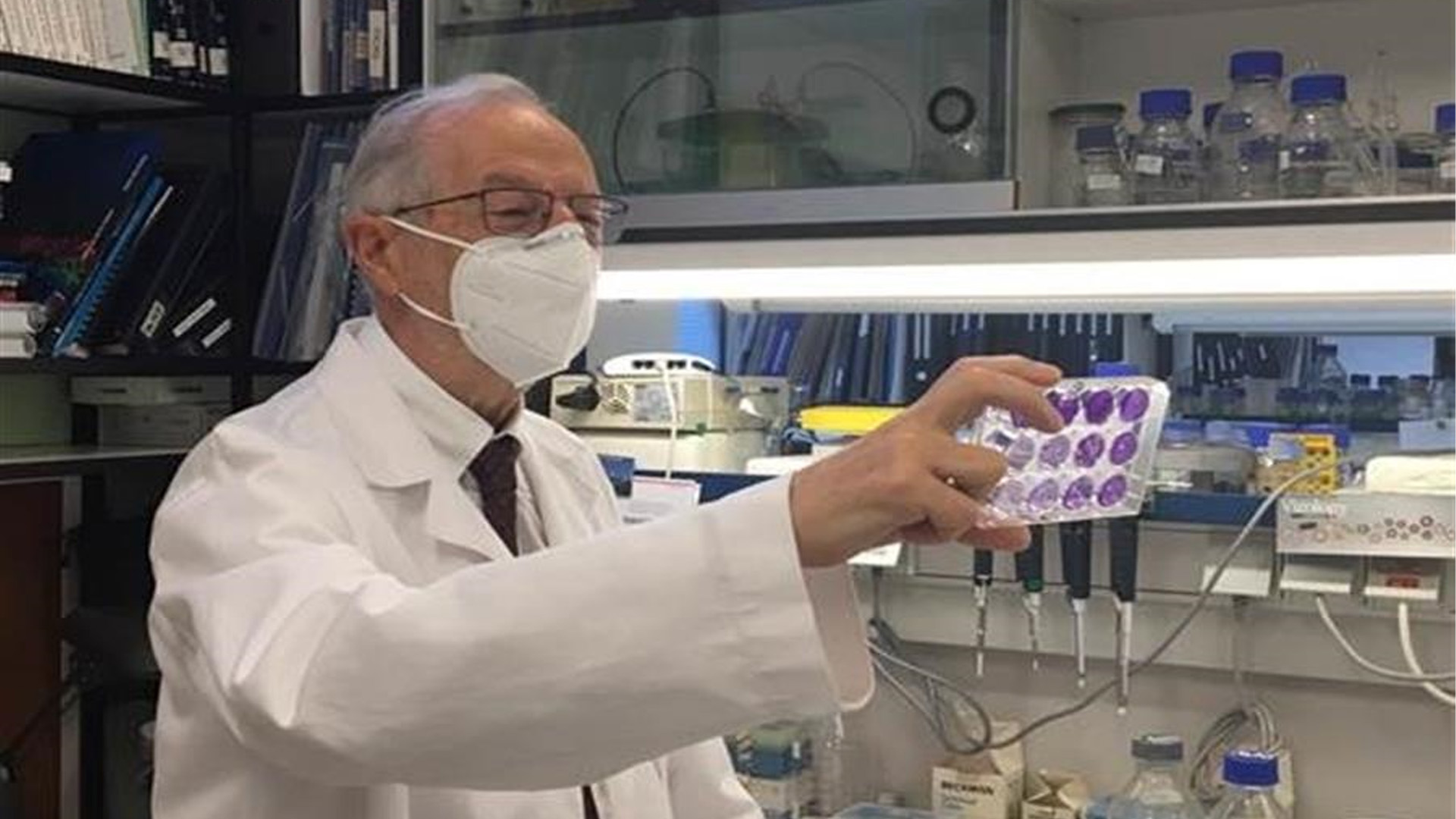 Anticuerpos en sangre y saliva en enfermos de COVID-19 podría durar al menos tres meses - covid-mundo2