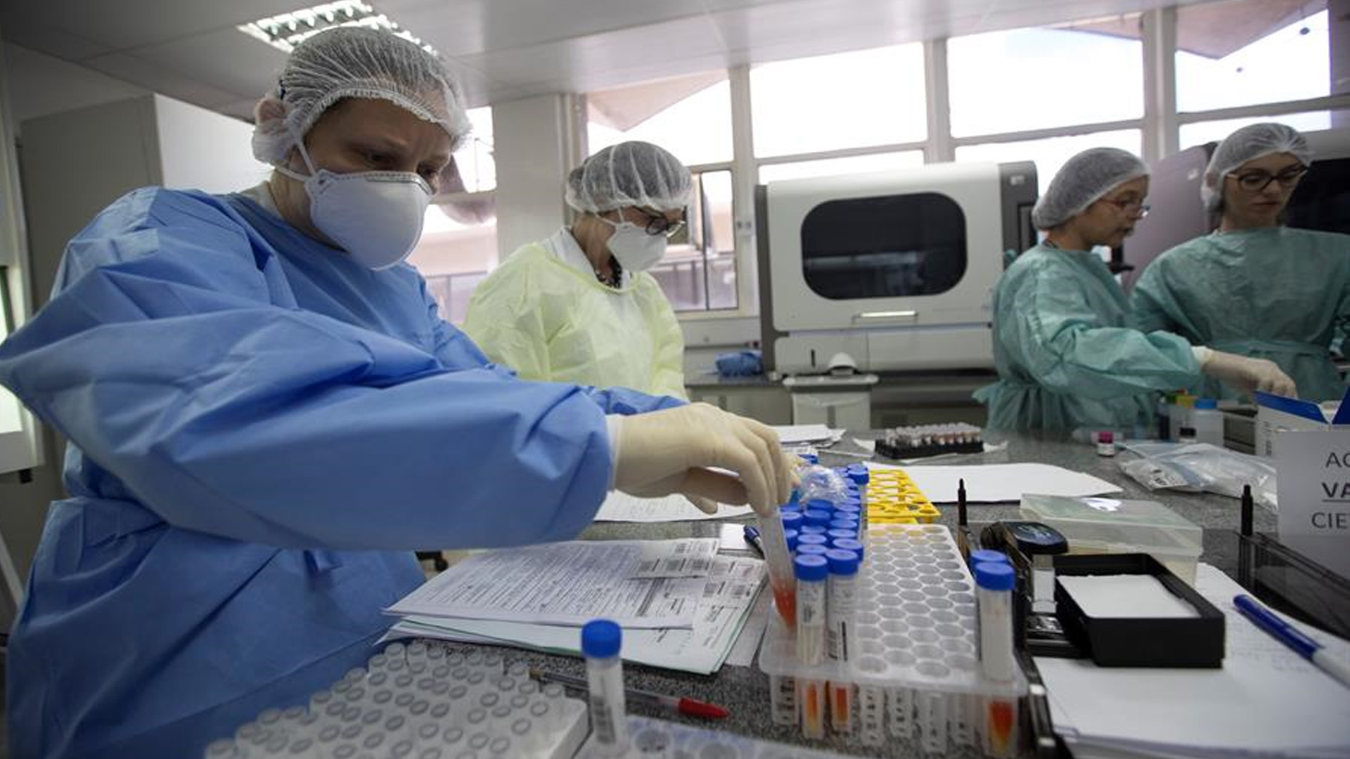 El mundo registra 304 mil casos nuevos y 5 mil muertes por COVID-19 en las últimas 24 horas