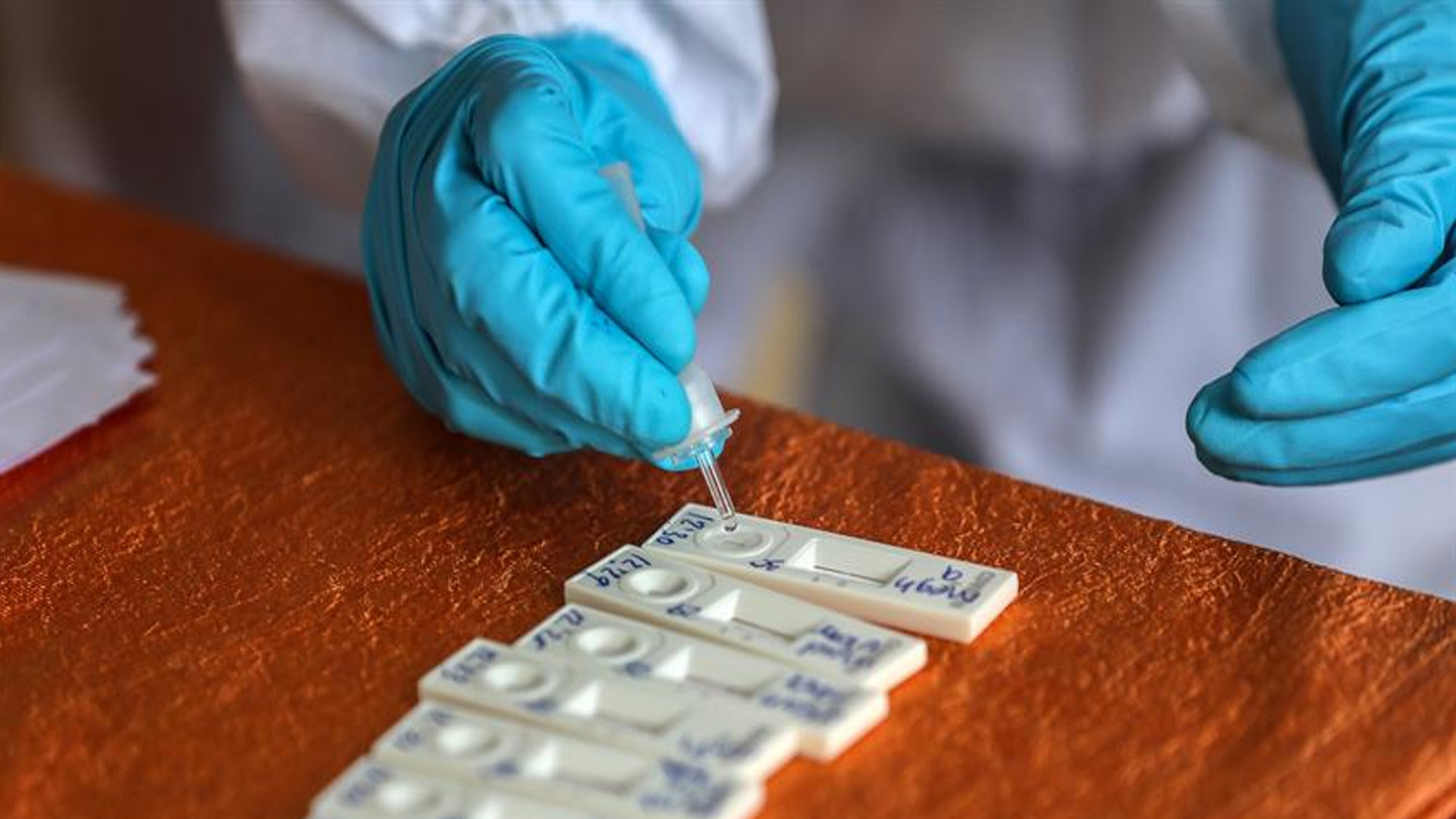 Desarrollan test de anticuerpos de COVID-19 con gusanos de seda