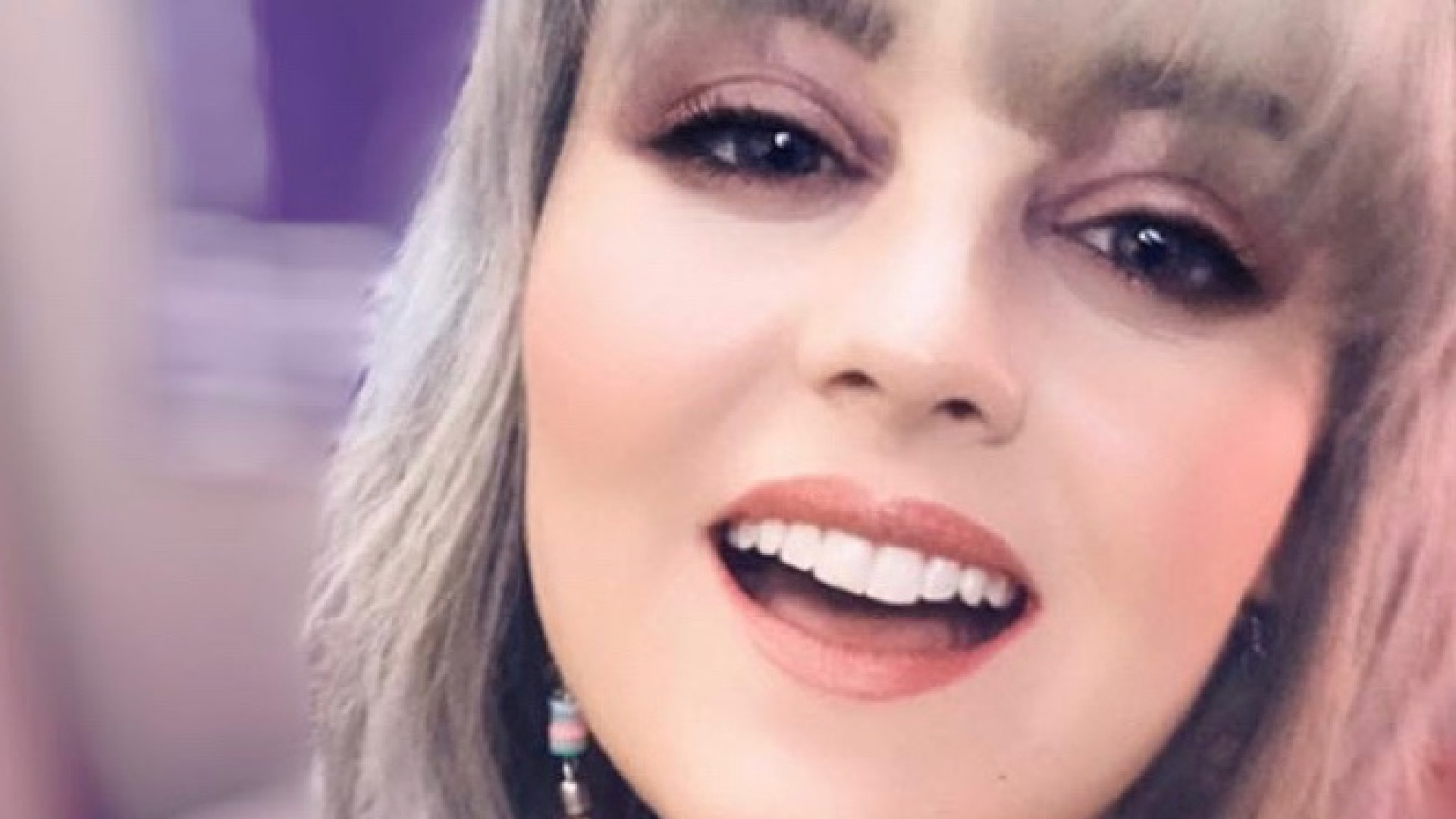 Allisson Lozz revela que podría perder la vista en los próximos años Allisson Lozz revela que podría perder la vista en los próximos años