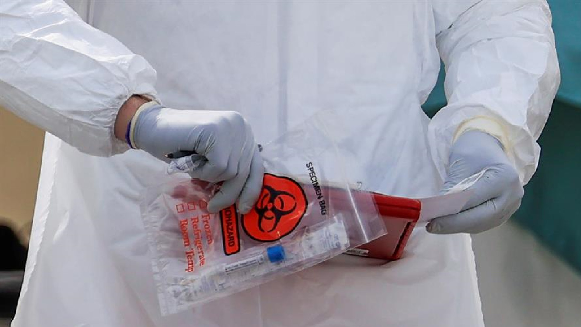 Aprueba EE.UU. primer test de COVID-19 para autodiagnóstico en casa; da resultado en 30 minutos