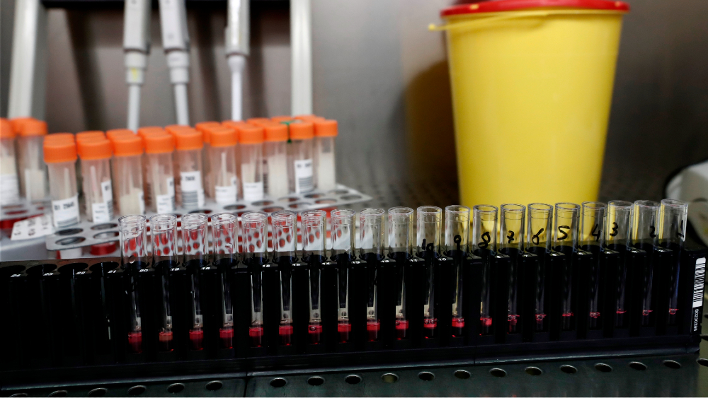 Segunda vacuna rusa contra COVID-19 tendrá una inmunidad de al menos seis meses