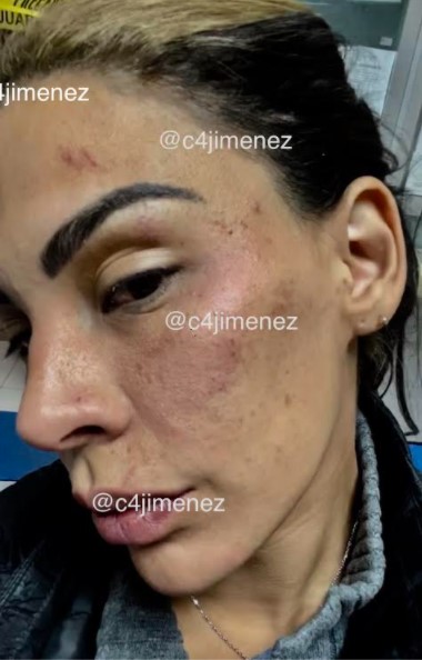 Eleazar Gómez obtiene libertad condicional; se someterá a tratamiento psicológico - lesiones-de-stephanie-valenzuela