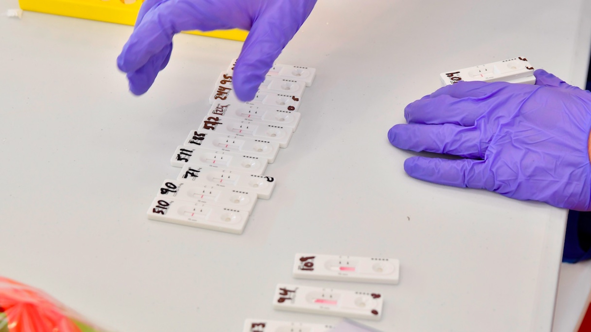 En ocho meses han muerto 442 periodistas a causa del COVID-19; en América Latina hay 251 decesos