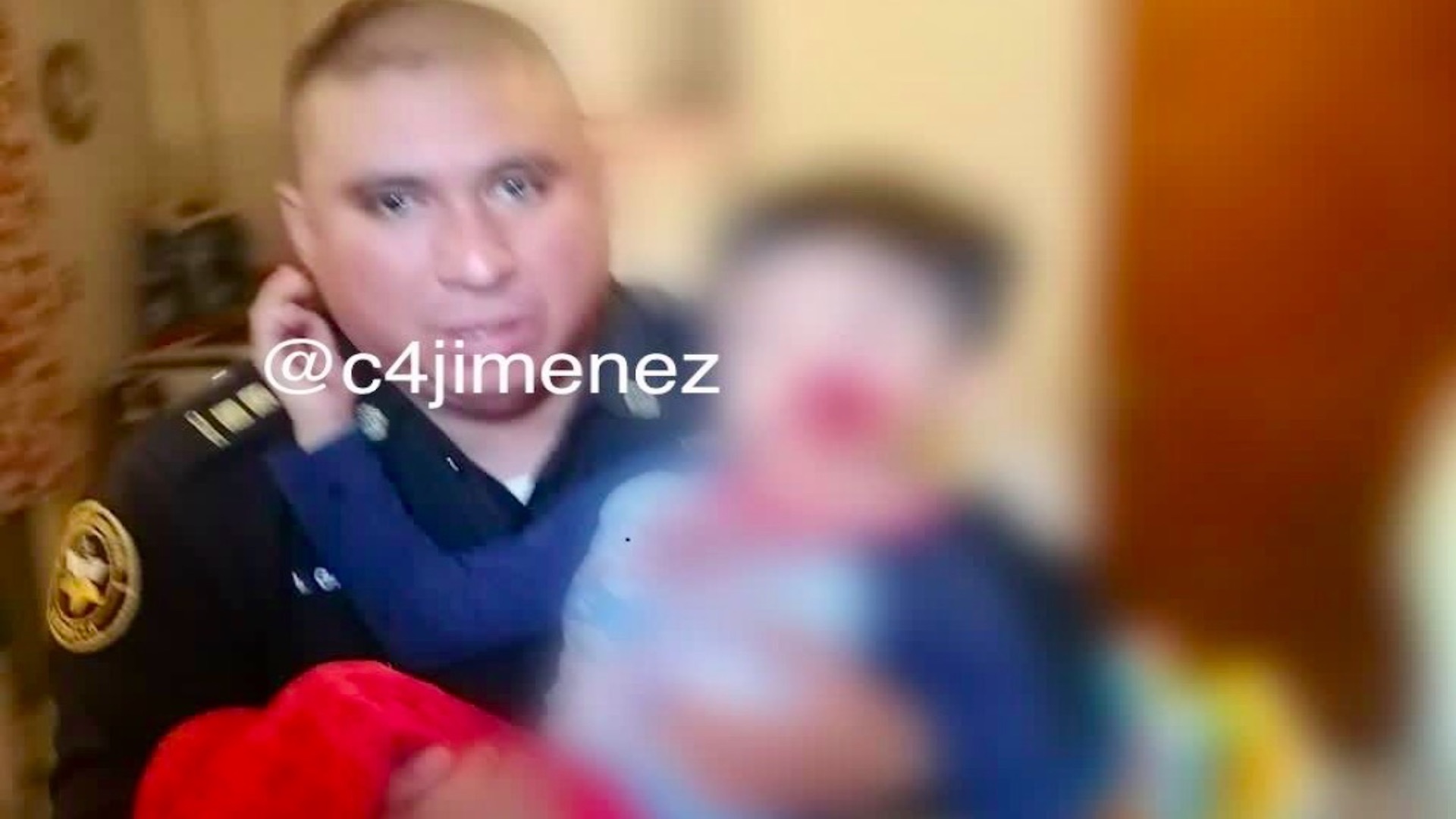 Perro pitbull muerde, en la cara, a niño de cinco años en la alcaldía Iztapalapa