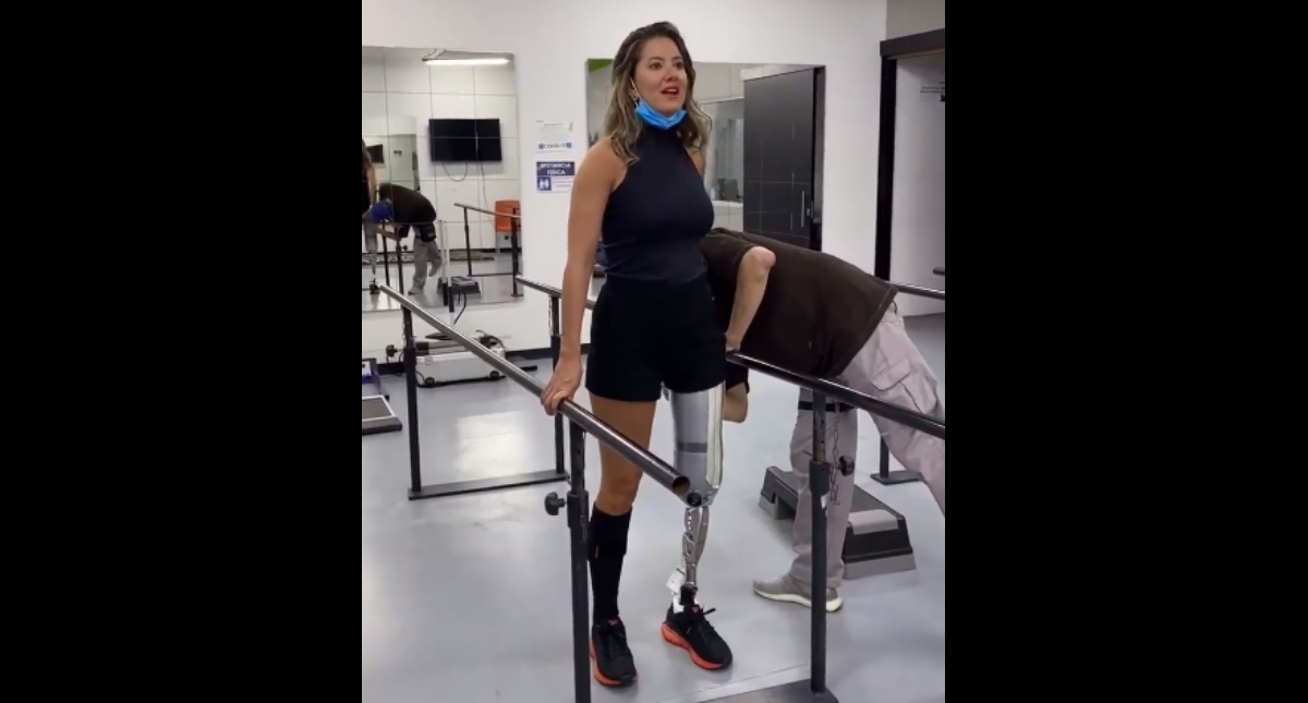 #Video Daniella Álvarez, Miss Colombia 2011-2012, da sus primeros pasos tras recibir prótesis de pierna