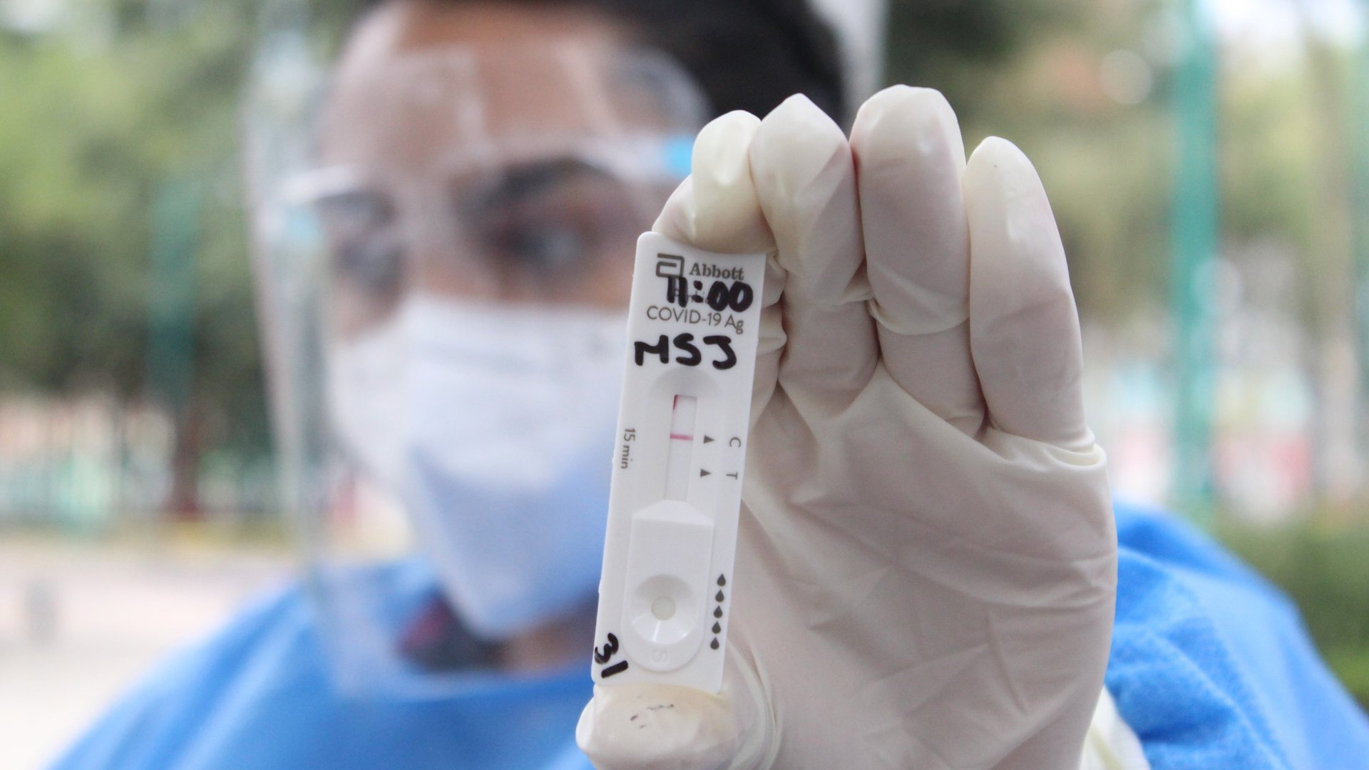 México registró el domingo 5 mil 211 casos nuevos y 362 muertes por COVID-19