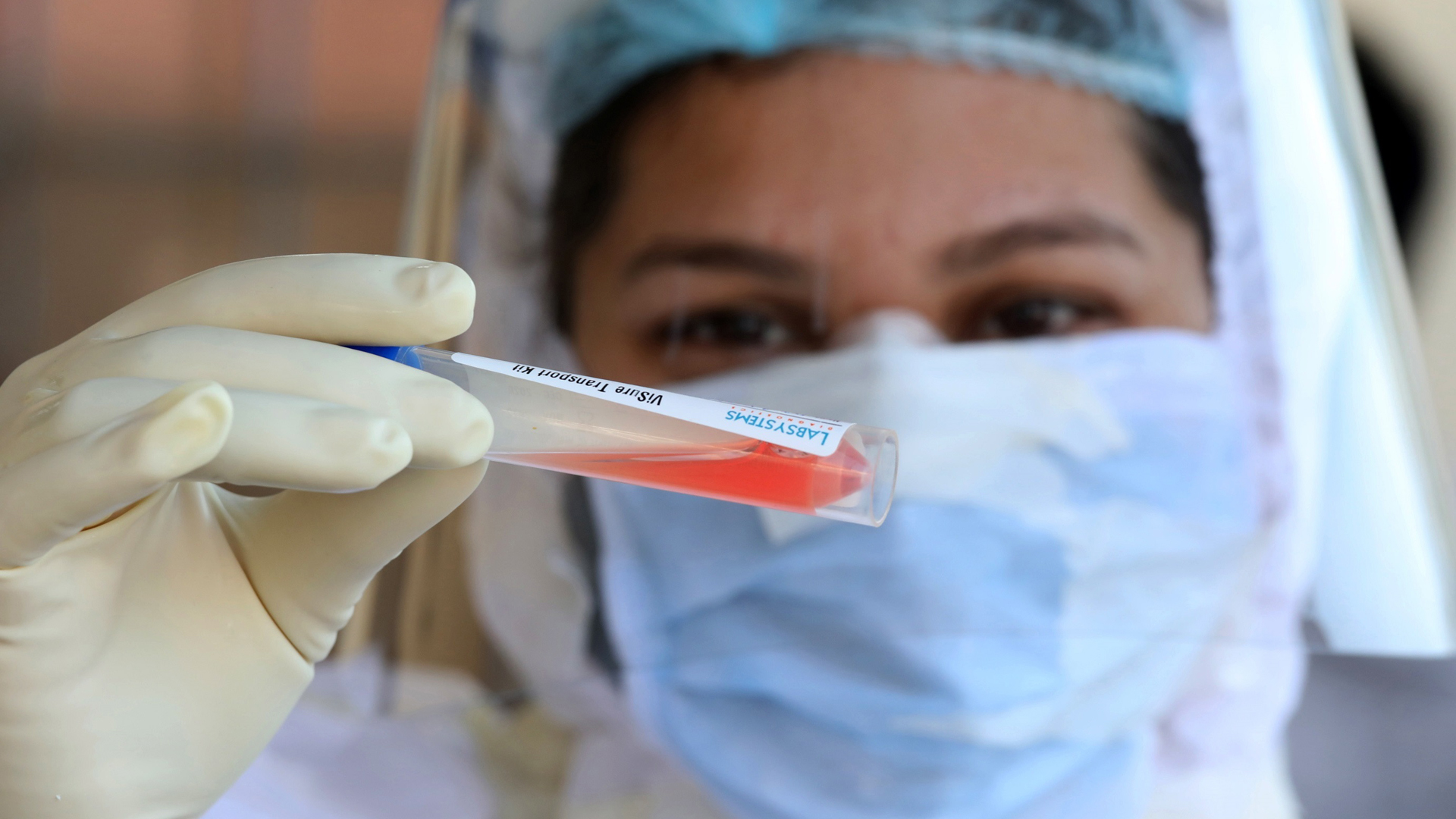 Detectan en Hidalgo primer caso de variante británica de COVID-19