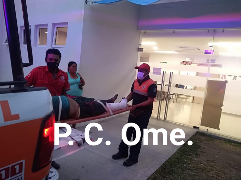 Explosión de polvorín deja tres heridos en Ometepec, Guerrero - quemados-polvorin-explosion-3