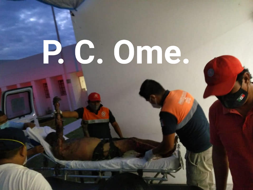 Explosión de polvorín deja tres heridos en Ometepec, Guerrero - quemados-polvorin-explosion-4