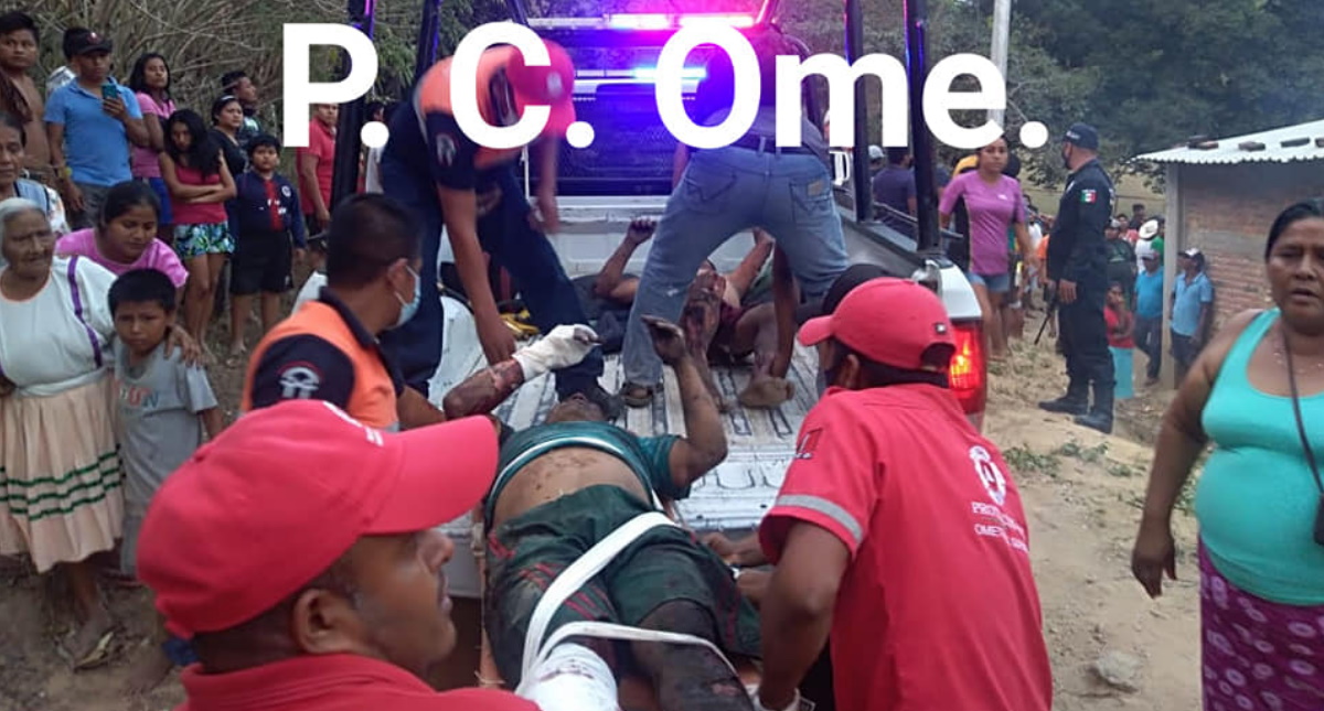 Explosión de polvorín deja tres heridos en Ometepec, Guerrero - quemados-polvorin-explosion