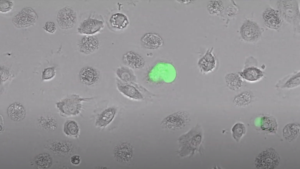 Células humanas inmunitarias disponen de una alarma natural contra el VIH