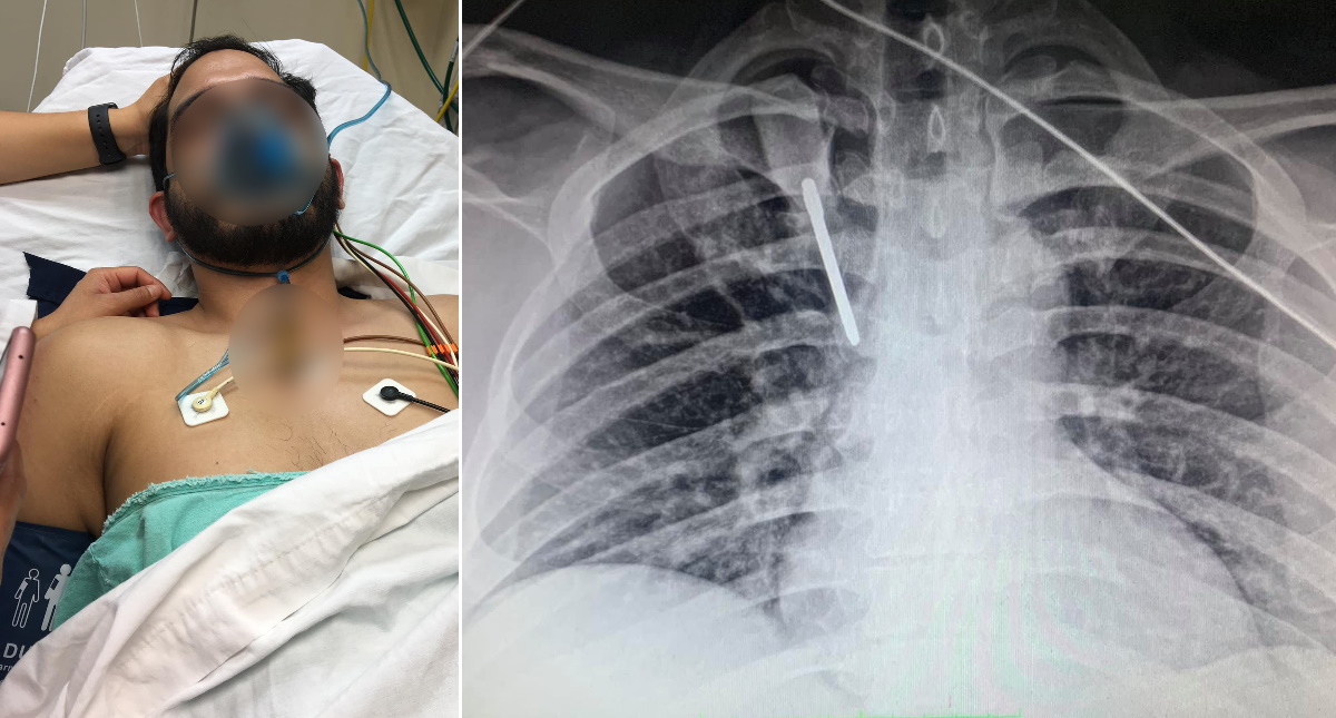 Residente de hospital del IMSS en Monterrey está fuera de peligro tras ataque con desarmador