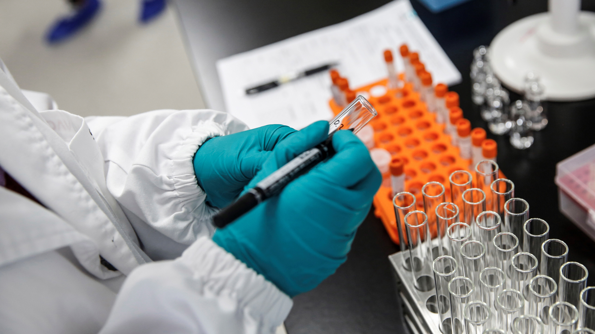 Mieloma múltiple duplica riesgo de contagio y muerte por COVID-19 Mieloma múltiple duplica riesgo de contagio y muerte por COVID-19