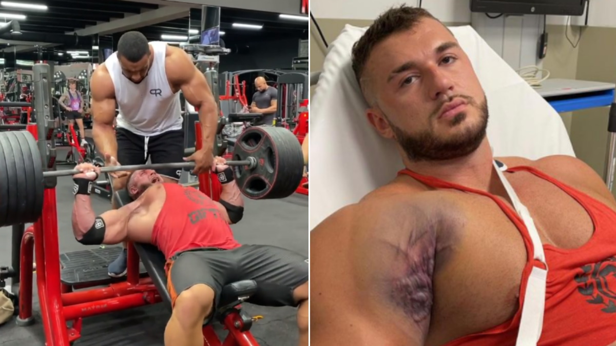 #Video Fisicoculturista sufre aparatosa lesión durante entrenamiento; se le desprende tendón del hueso #Video Fisicoculturista sufre aparatosa lesión durante entrenamiento; se le desprende tendón del hueso