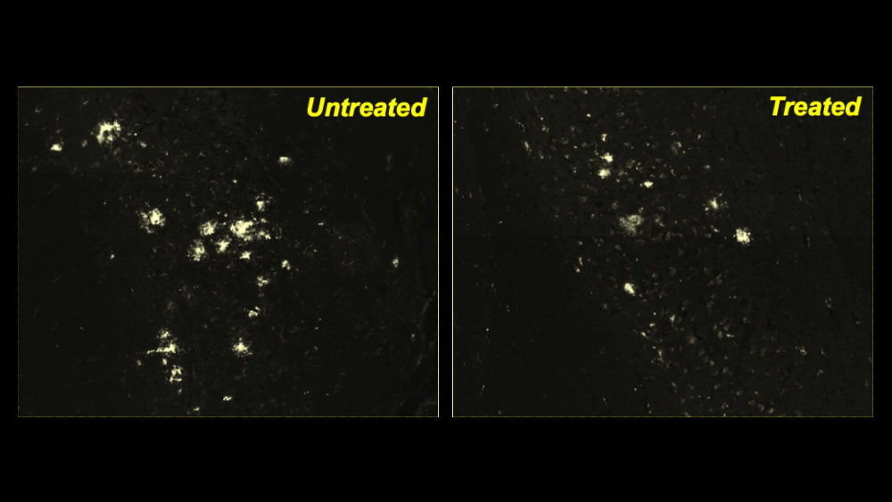 Desarrollan un fármaco que revierte síntomas del alzhéimer en ratones Desarrollan un fármaco que revierte síntomas del alzhéimer en ratones