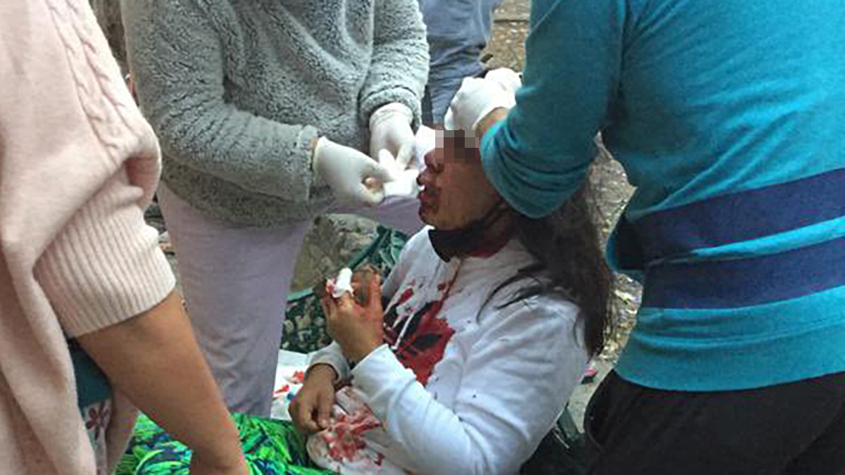 #Video Sujeto golpea con piedra a vecina de Tlatelolco para robarle el celular - atencion-medica-en-tlatelolco-a-mujer-golpeada-con-una-piedra