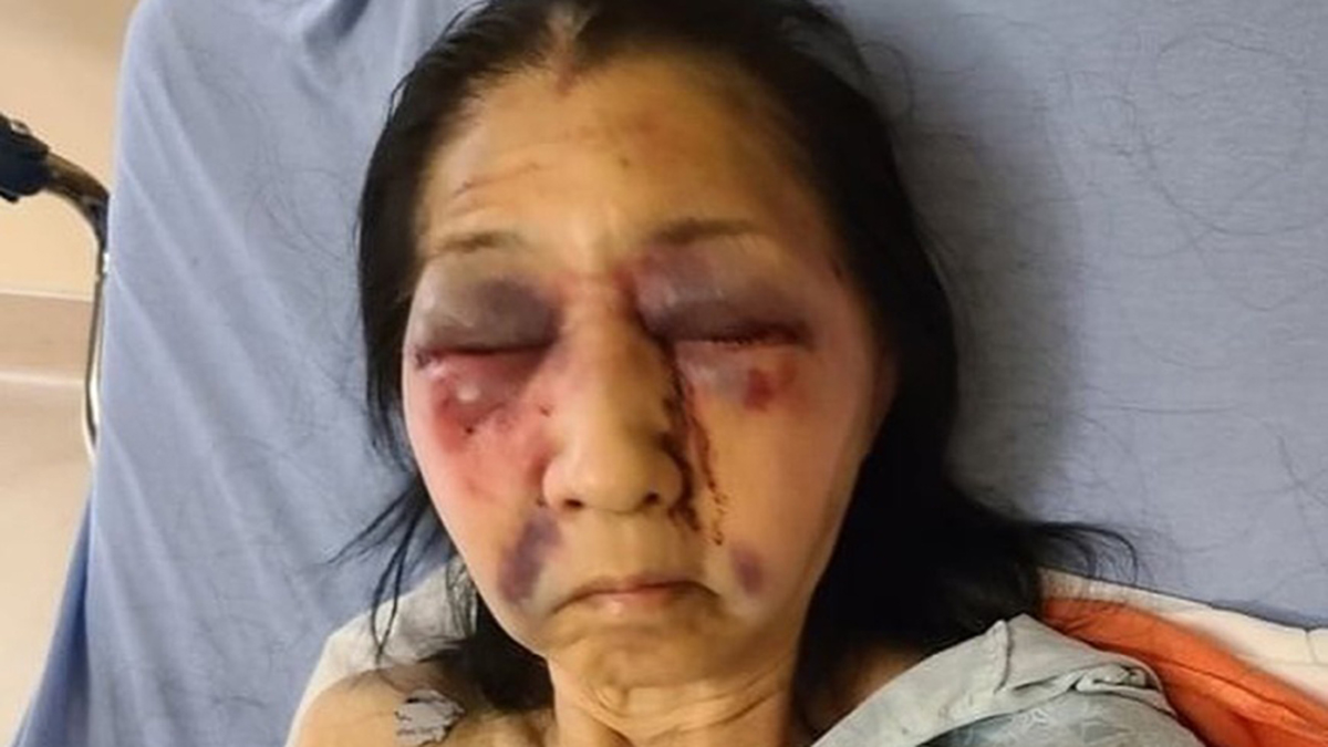 Golpean en Los Ángeles a adulta mayor mexicana; la confundieron con asiática