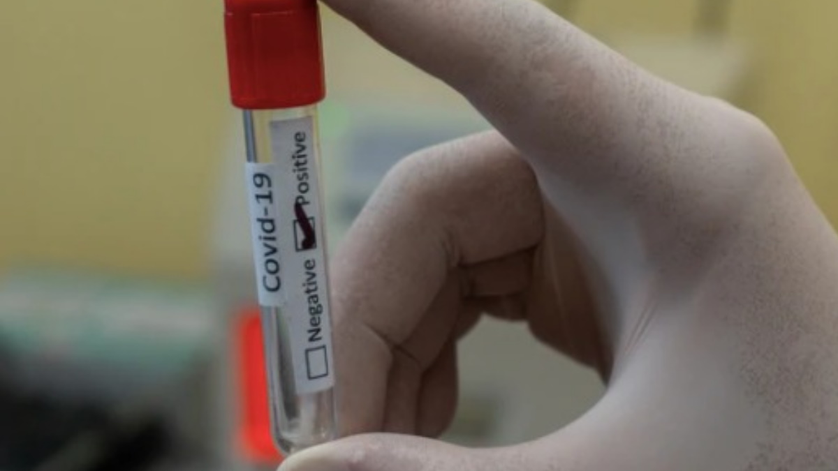 Detectan en Túnez nueva variante de coronavirus; envían muestras a OMS - covid-19-prueba-doctor-medico