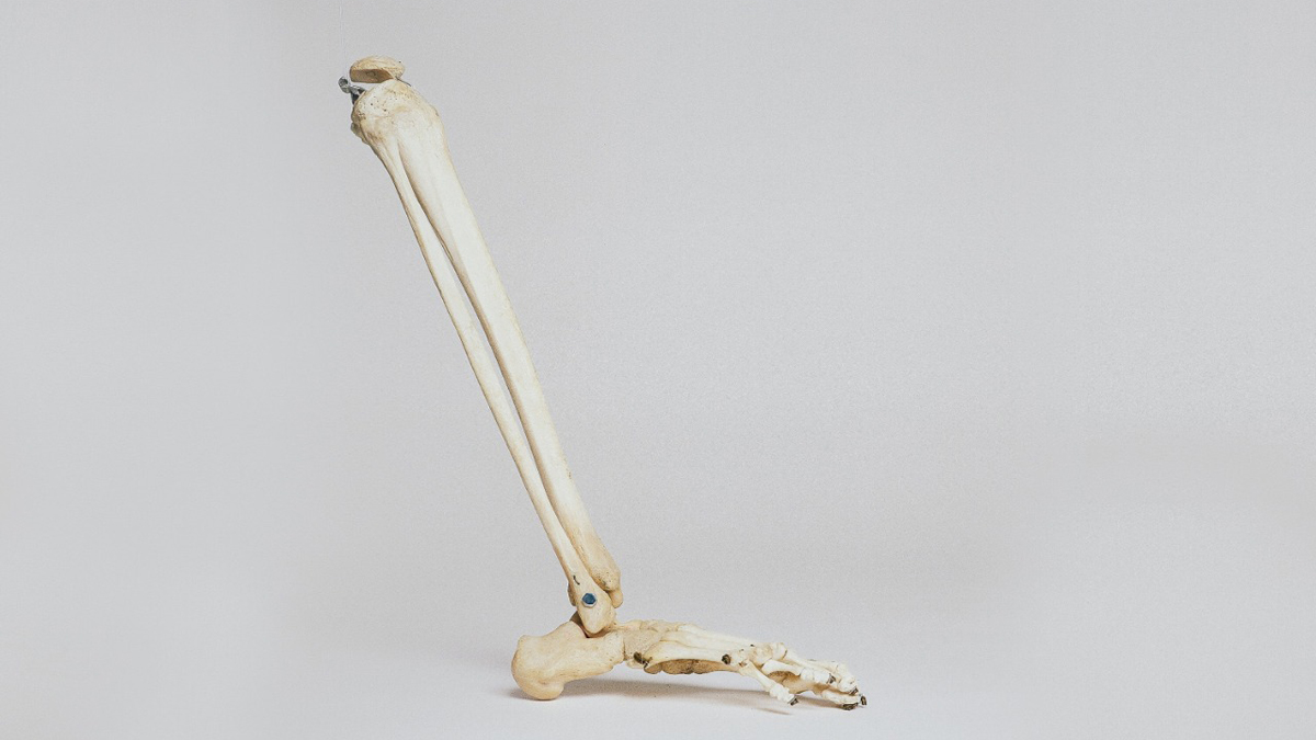 Desarrolla UNAM parche transdérmico contra la osteoporosis