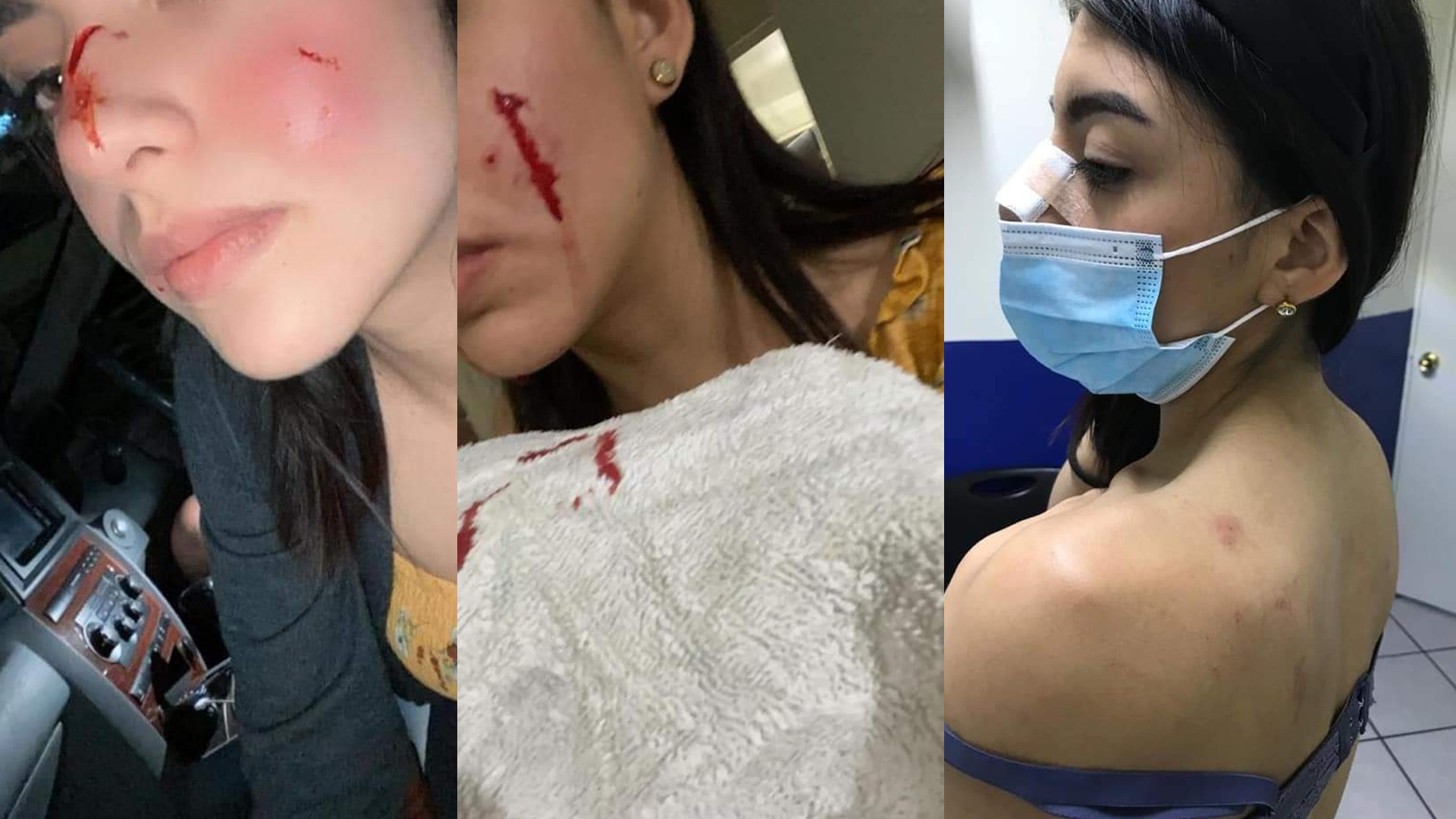 Novia de presunto asesino de Rodolfo Corazón revela agresión del perro; “no soy cómplice” del asesinato, afirma