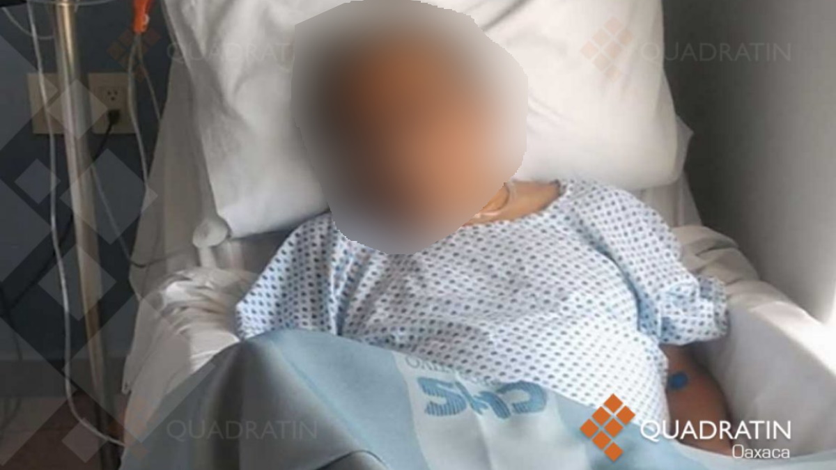 Se registra el primer supuesto caso de trombosis asociada a vacuna de AstraZeneca contra COVID-19 - paciente-naucalpan-trombosis-vacuna-2