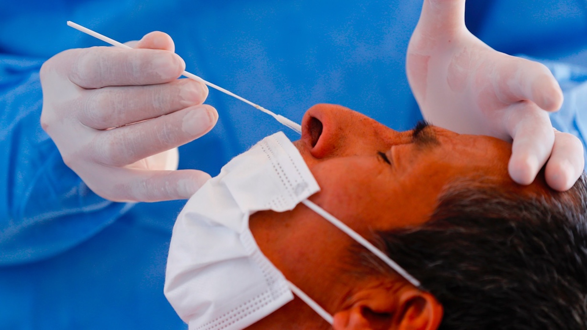 México registró en las últimas 24 horas 454 muertes y 5 mil 381 casos de COVID-19