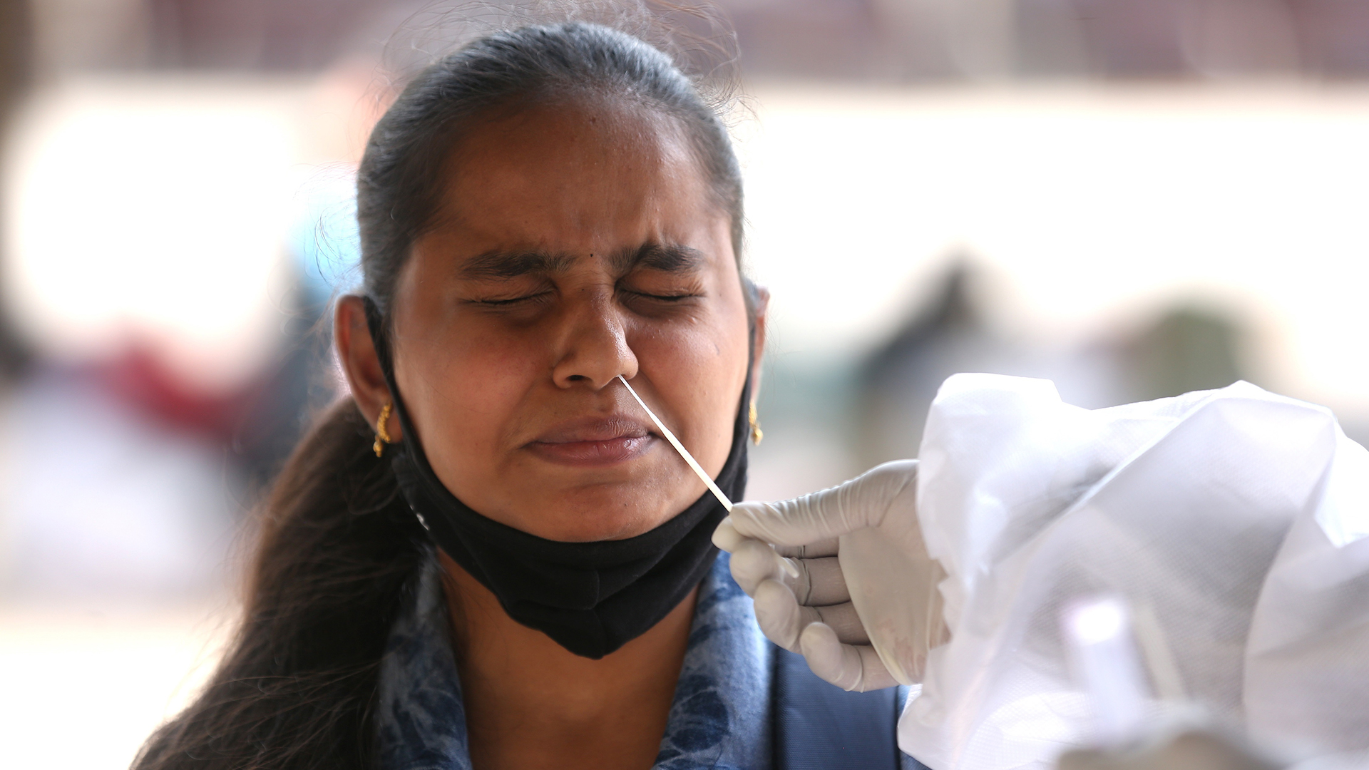 Personas con COVID-19 grave tienen menor respuesta antiviral en la nasofaringe Personas con COVID-19 grave tienen menor respuesta antiviral en la nasofaringe