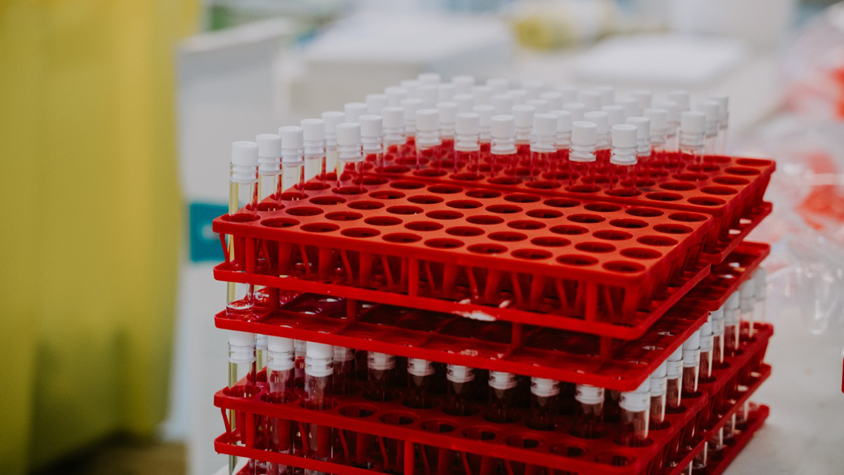 Vacunas resguardadas, para la aplicación de la segunda dosis: SHCP