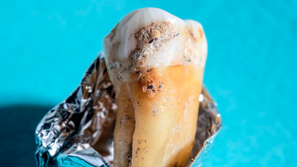 Reconstruyen la sorprendente evolución de nuestras bacterias orales