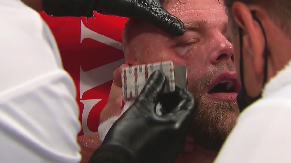 Hospitalizan a Saunders tras golpe del ‘Canelo’; “va a estar fuera mucho tiempo”, dice promotor Hospitalizan a Saunders tras golpe del ‘Canelo’; “va a estar fuera mucho tiempo”, dice promotor