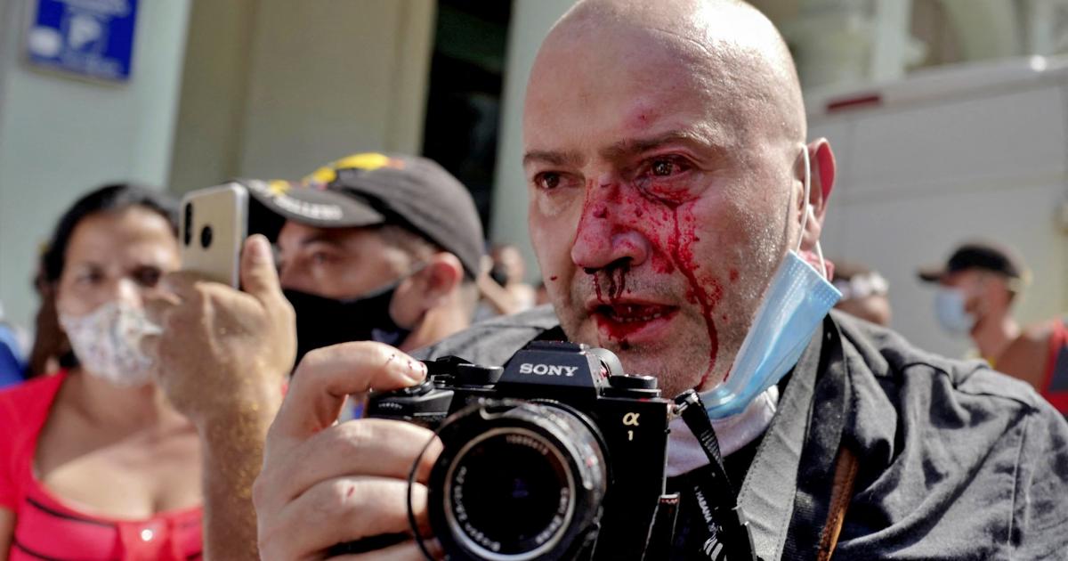 No nos distraigamos - 1626051816-policia-cubana-agrede-reconocido-fotografo-ap-mientras-cubria-protestas-habana